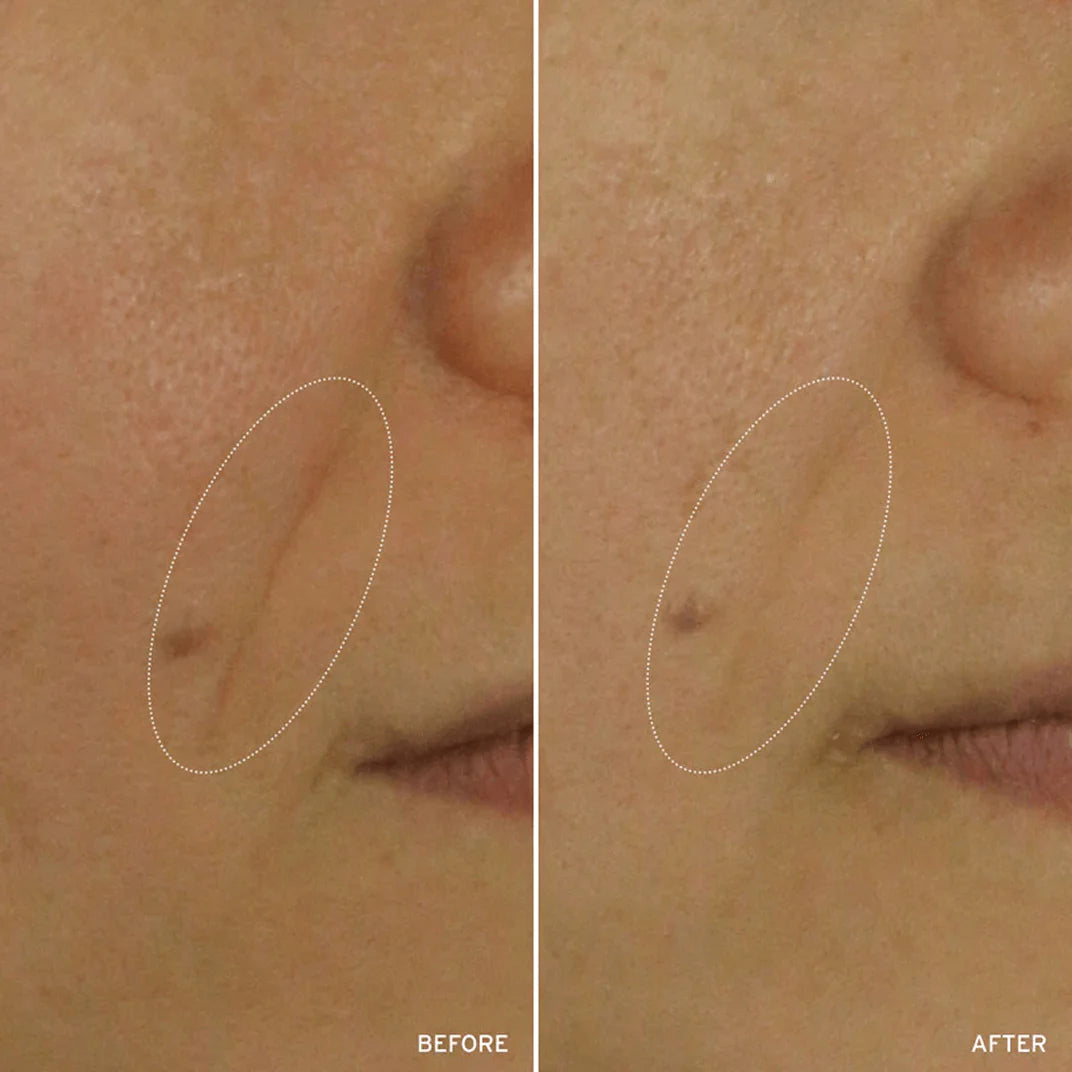 NAD+ Cell Energizing Treatment