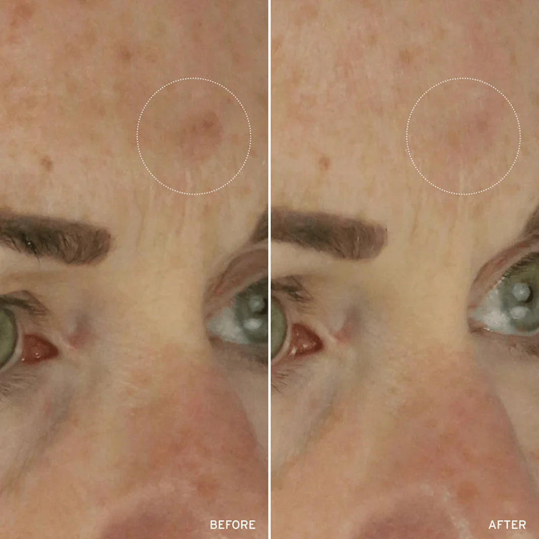 NAD+ Cell Energizing Treatment