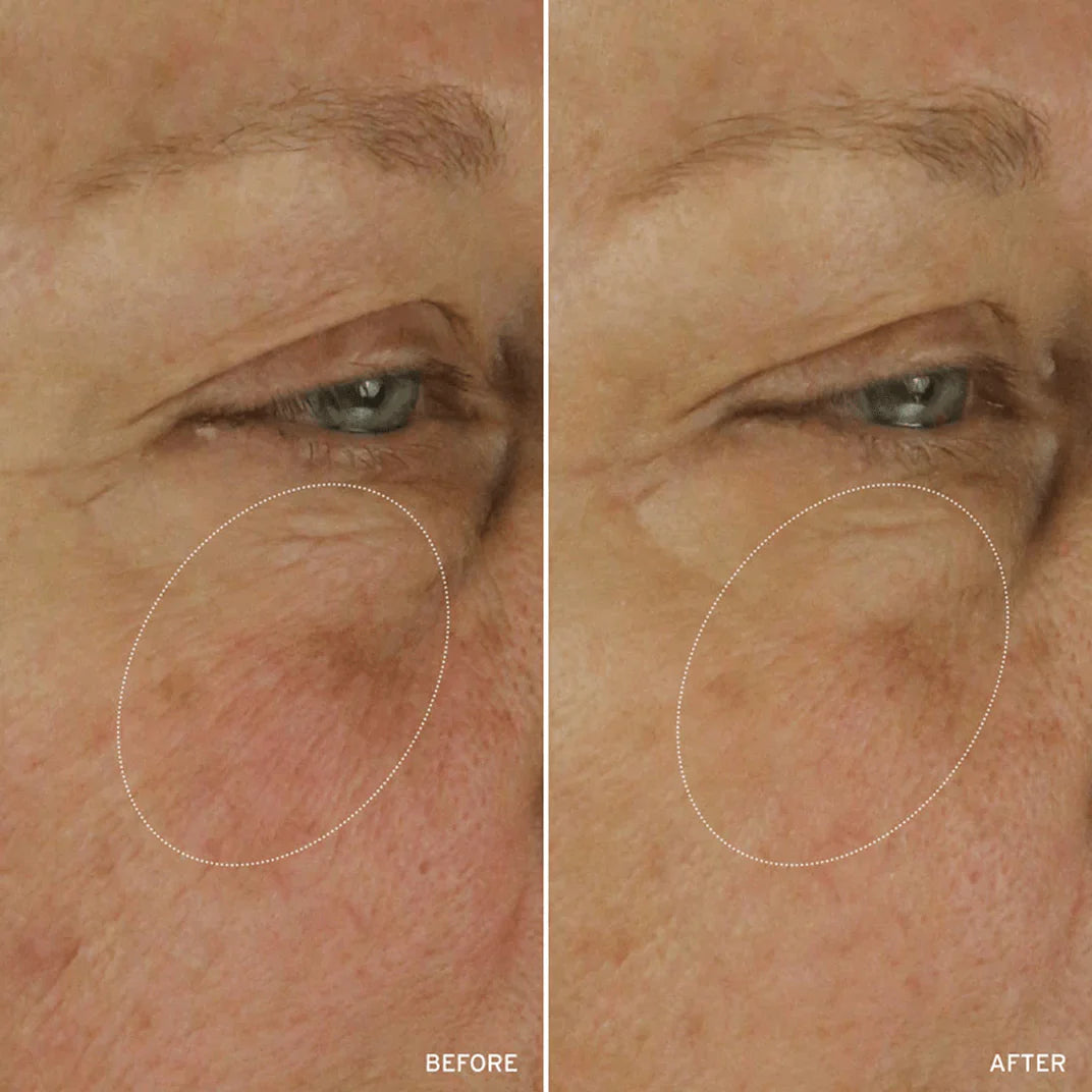 NAD+ Cell Energizing Treatment